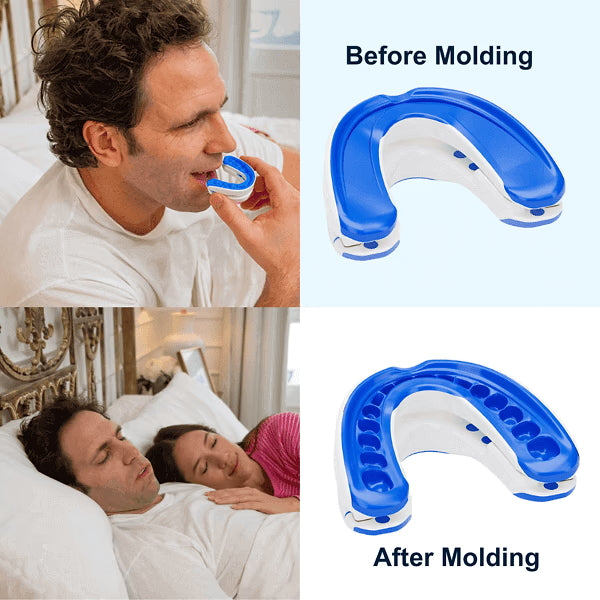 VitalSleep Anti-Snoring Mouthpiece