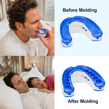 VitalSleep Anti-Snoring Mouthpiece