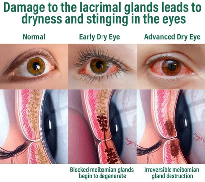 Nano Vision Repair Eye Serum ✅FDA Approved(Suitable for presbyopia, dry eye syndrome, glaucoma, and cataracts)