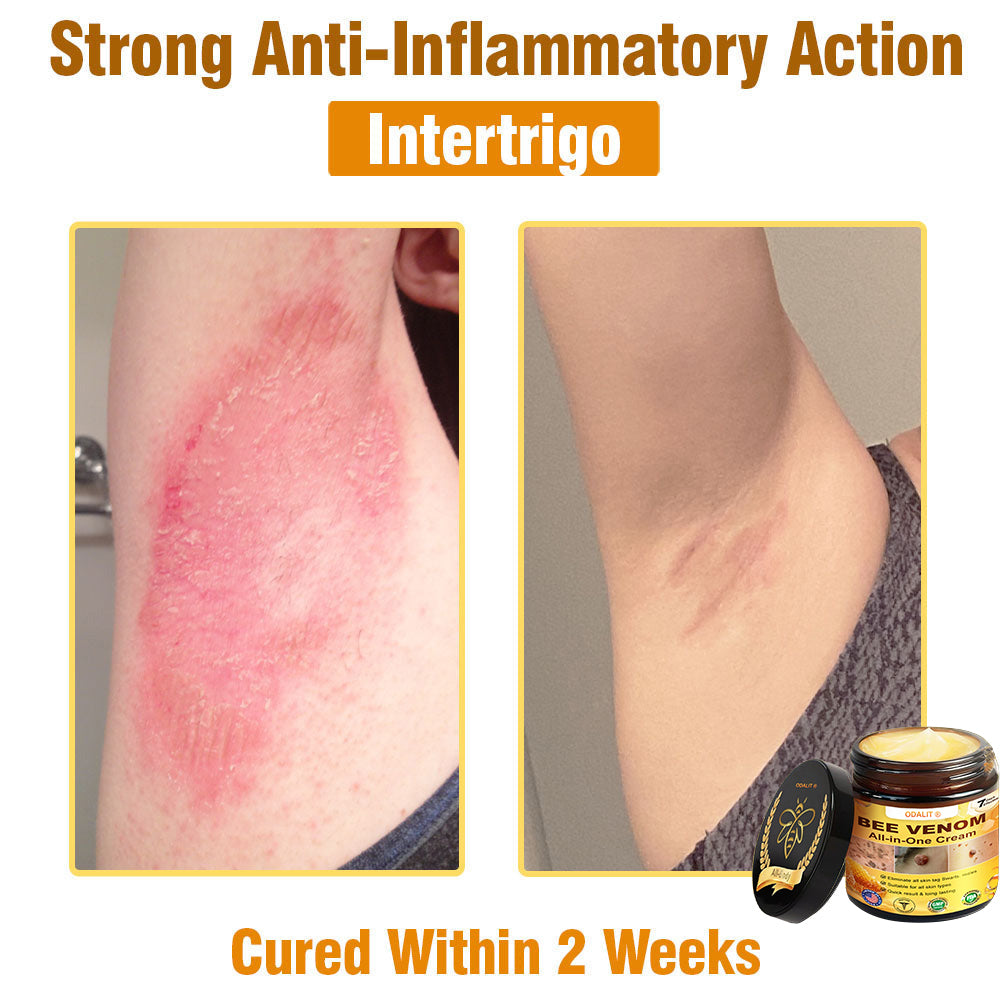 ODALIT™ Bee Poison All-in-One Cream US Dermatologist Approved