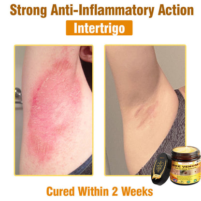 ODALIT™ Bee Poison All-in-One Cream US Dermatologist Approved