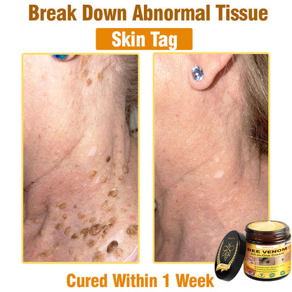 ODALIT™ Bee Poison All-in-One Cream US Dermatologist Approved