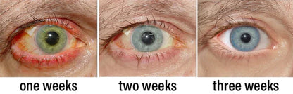 Nano Vision Repair Eye Serum ✅FDA Approved(Suitable for presbyopia, dry eye syndrome, glaucoma, and cataracts)