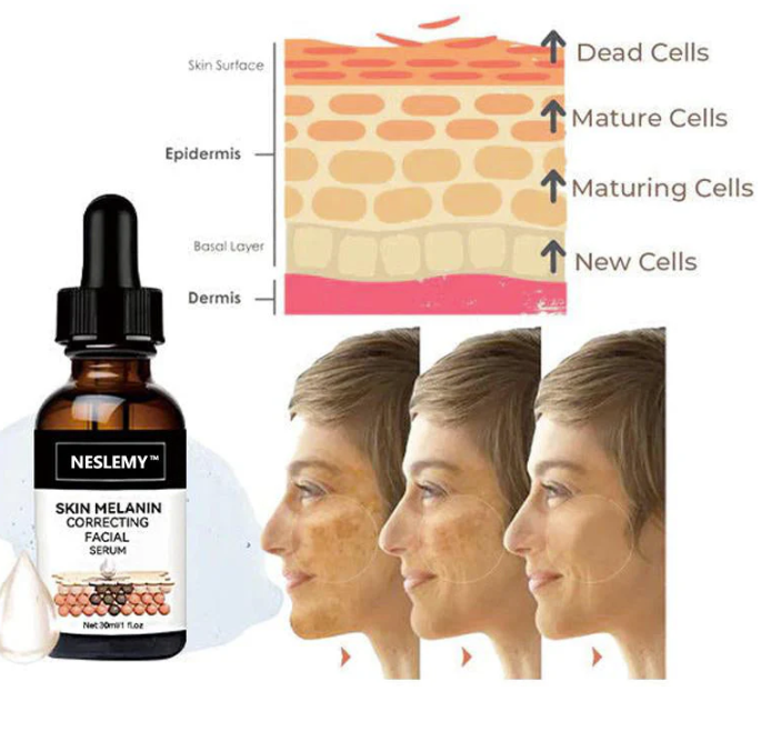 ✨Fast Dark Spot Remover-NESLEMY™ Melanin Correcting Facial Serum