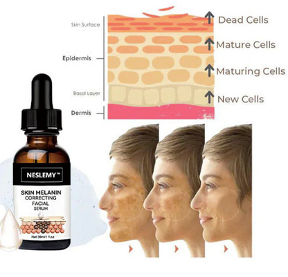 ✨Fast Dark Spot Remover-NESLEMY™ Melanin Correcting Facial Serum