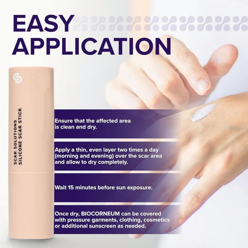 Skin Scar Solutions🛡️ 60%  Silicone Scar Stick