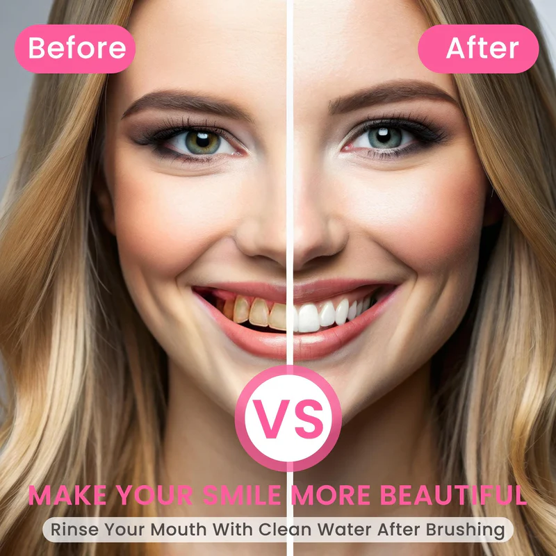 🔥Final Day: 60% OFF Nicotinamide Whitening Toothpaste