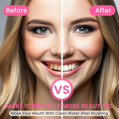 🔥Final Day: 60% OFF Nicotinamide Whitening Toothpaste