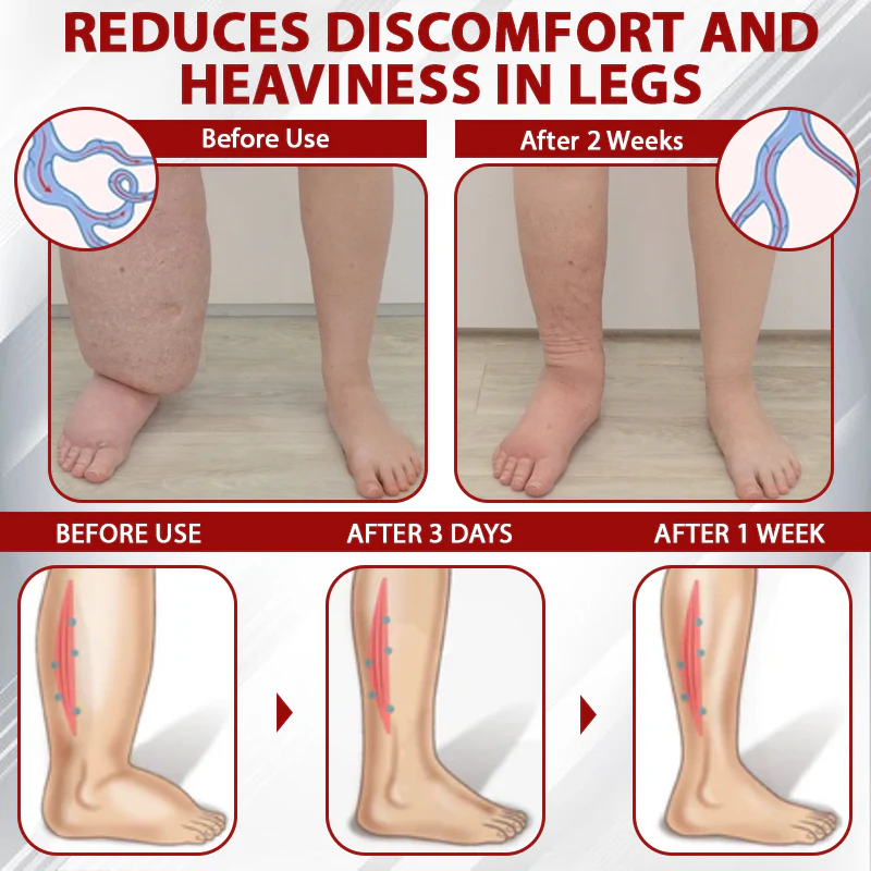 Boost Circulation and Relieve Swelling 🚶‍♀️💨
