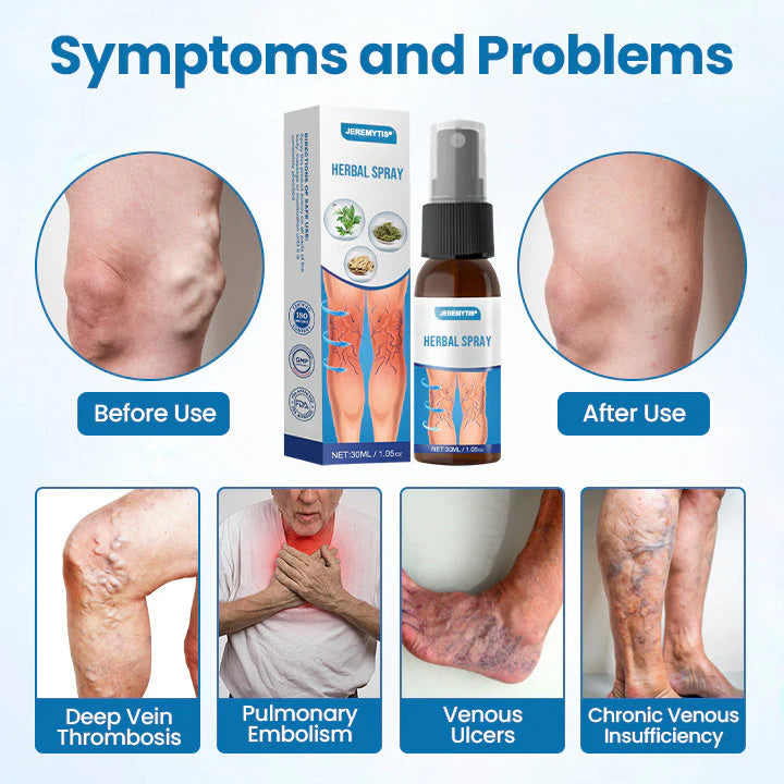 【Official Flagship Store】Erase Varicose Veins in Just 7 Days⏱️