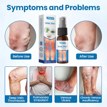【Official Flagship Store】Erase Varicose Veins in Just 7 Days⏱️