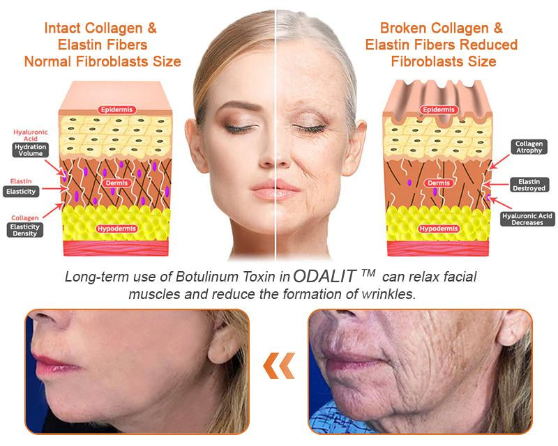 FDA Approved: ODALIT® Bee Venom Skin Restoration Cream — 🔥Limited Time 70% OFF🔥