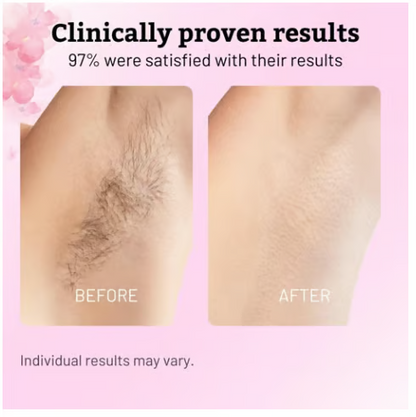 ⏰Limited-Time Offer - Get a Free Manual Razor🎁| Cyperus Rotundus Oil