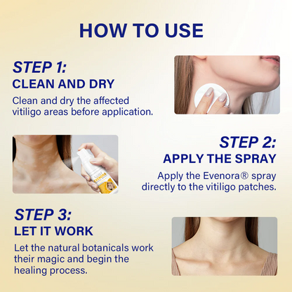 【Official Flagship Store】Evenora Herbal Spray