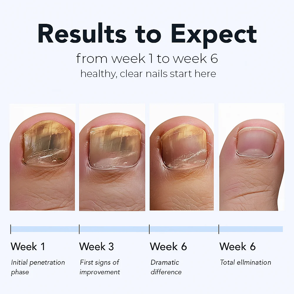 【Official Flagship Store】🎁 Buy 1 Get 1 Free - Fungal Nail Renewal Patches