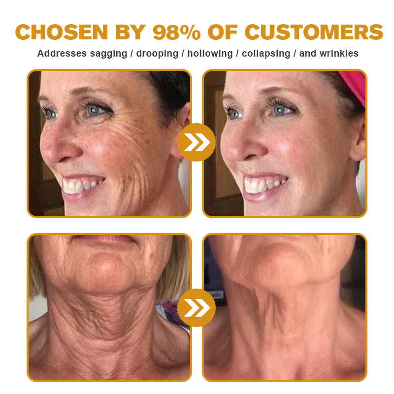 (Made and Shipped from USA) 🧑‍⚕️NEGUSY® Botox Bee Venom Wrinkle Removal Cream