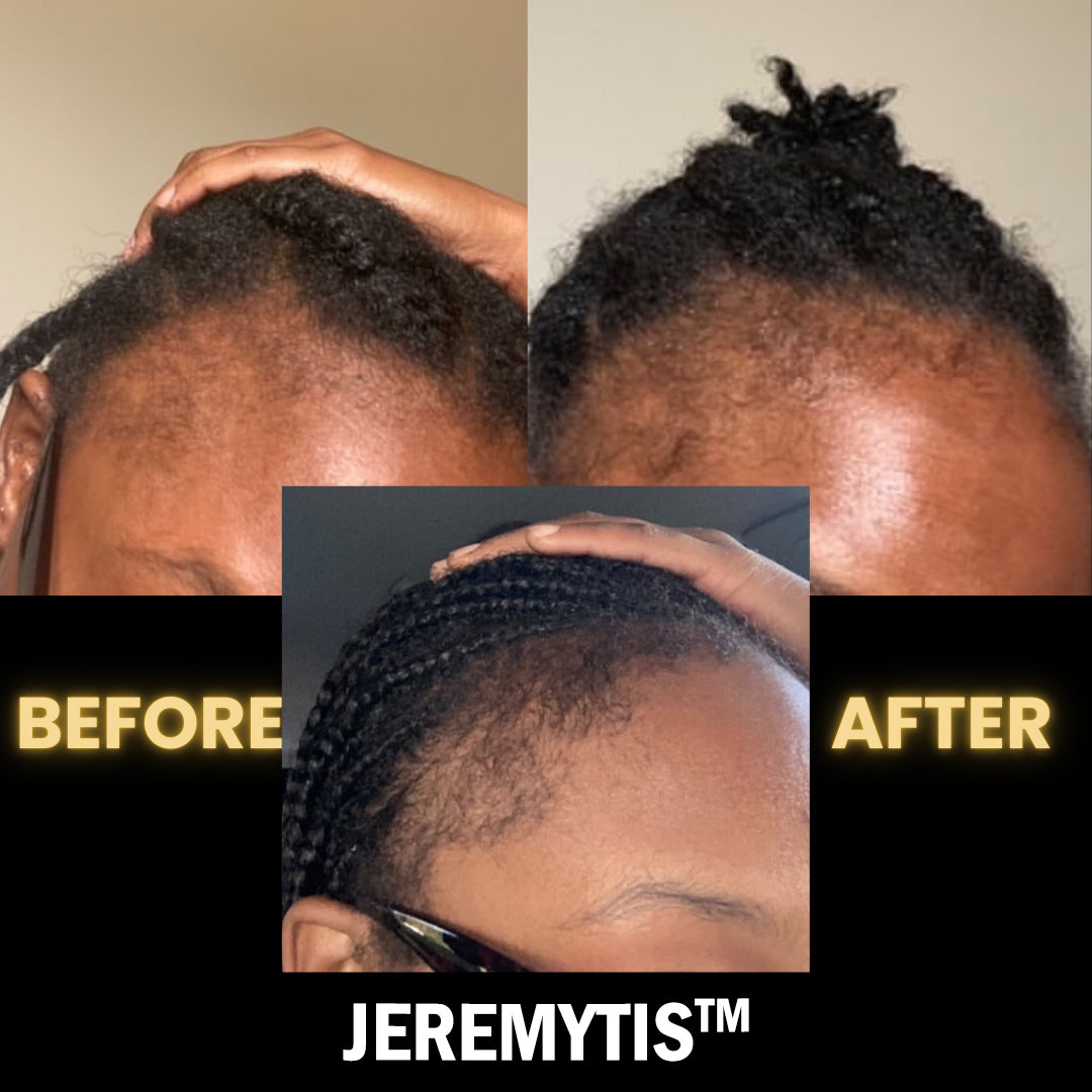 Stimulating Scalp and Hair Balm