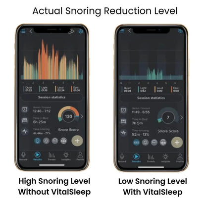 VitalSleep Anti-Snoring Mouthpiece